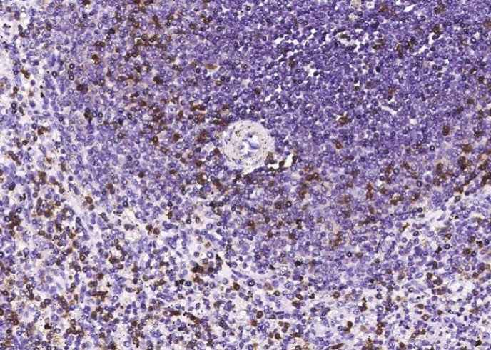 Anti-Human CD2 Antibody [A849] - ABMIUM