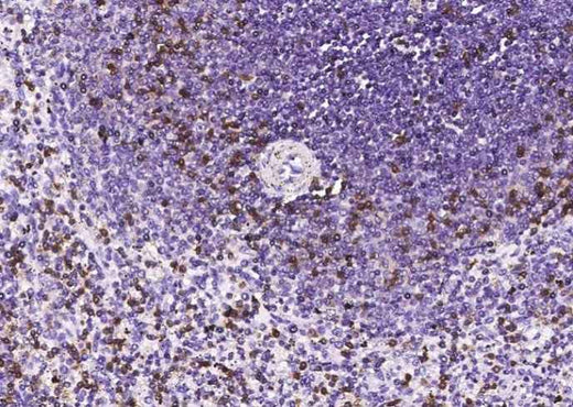 Anti-Human CD2 Antibody [A849] - ABMIUM