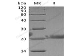 Recombinant Human Lacritin/LACRT Protein (His Tag) - ABMIUM
