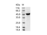 Recombinant MERS-CoV Nucleoprotein / NP protein (His Tag) - ABMIUM