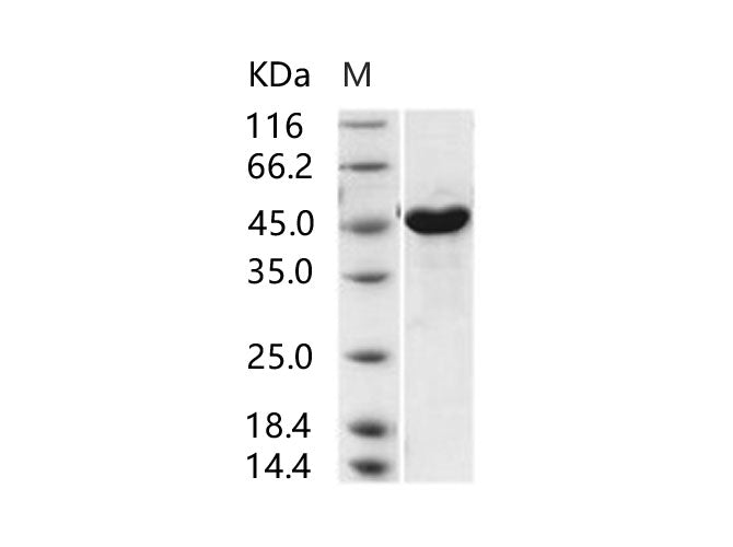 Recombinant MERS-CoV Nucleoprotein / NP protein (His Tag) - ABMIUM