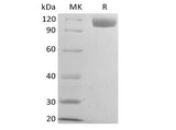 Recombinant Mouse B-cell Receptor CD22/Siglec-2/CD22 (C-6His) - ABMIUM