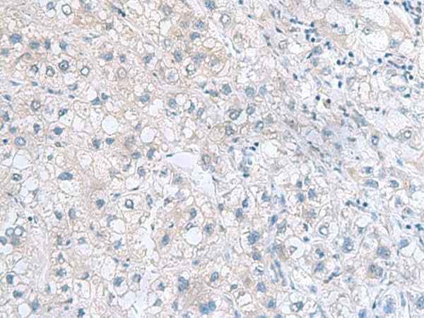 Anti-Human/Mouse MYDGF Antibody