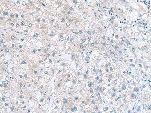 Anti-Human/Mouse MYDGF Antibody
