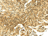 Anti-Human/Mouse SHPRH Antibody - ABMIUM