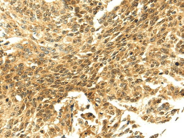Anti-Human/Mouse SHPRH Antibody - ABMIUM