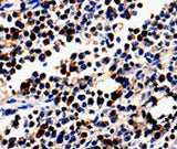 Anti-Human/Mouse/Rat ALOX5 Antibody - ABMIUM