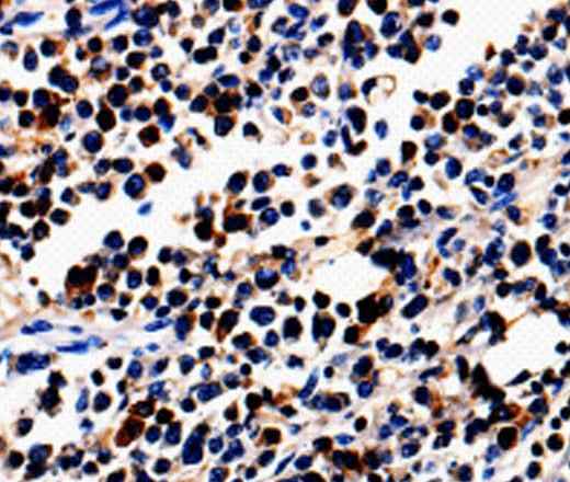 Anti-Human/Mouse/Rat ALOX5 Antibody