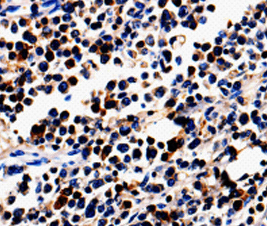 Anti-Human/Mouse/Rat ALOX5 Antibody - ABMIUM