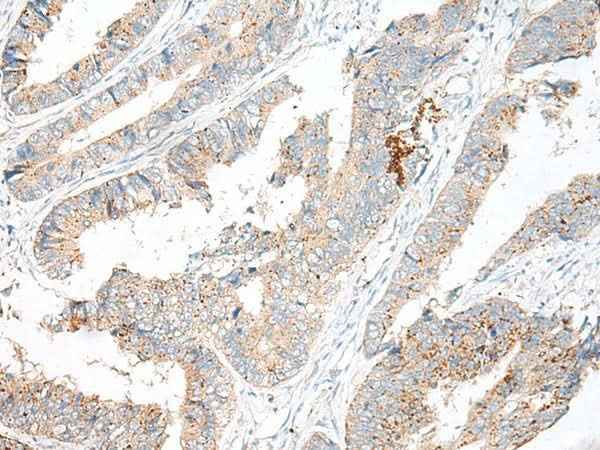 Anti-Human/Mouse GARNL3 Antibody