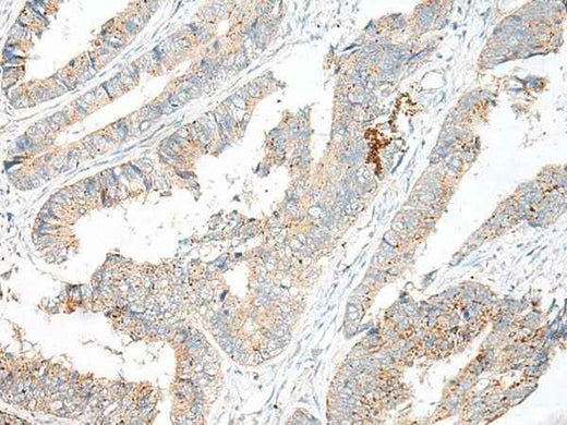 Anti-Human/Mouse GARNL3 Antibody