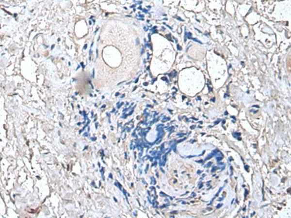 Anti-Human/Mouse/Rat PTP4A1 Antibody