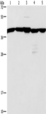 Anti-Human/Mouse/Rat GNA13 Antibody - ABMIUM