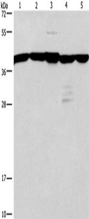 Anti-Human/Mouse/Rat GNA13 Antibody - ABMIUM