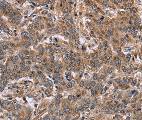 Anti-Human FAAH2 Antibody - ABMIUM