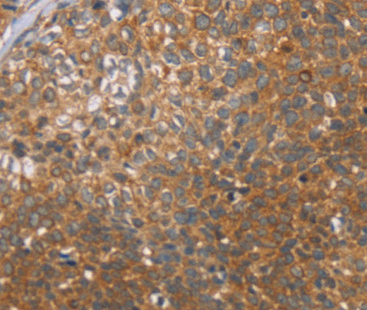 Anti-Human CCL21 Antibody - ABMIUM