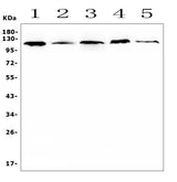 Anti-HIF-1 alpha/HIF1A Antibody Picoband® Boster Bio