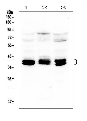 Anti-CXCR4 Antibody Picoband® Boster Bio