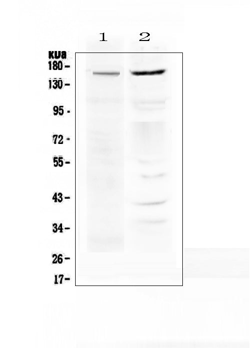 Anti-P Glycoprotein/ABCB1 Antibody Picoband® Boster Bio
