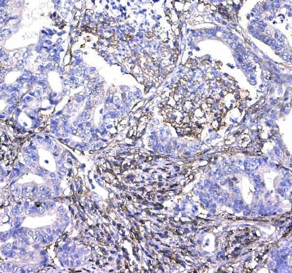 Anti-CD44 Antibody Picoband® Boster Bio
