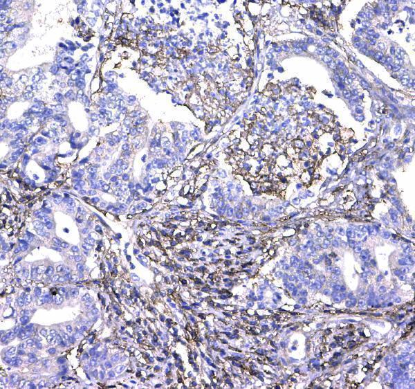 Anti-CD44 Antibody Picoband® Boster Bio