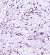 Anti-CXCL12 Antibody Boster Bio