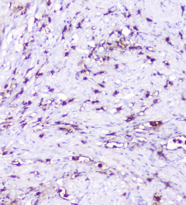 Anti-CXCL12 Antibody Boster Bio