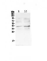 Anti-CCR5 Antibody Picoband® Boster Bio