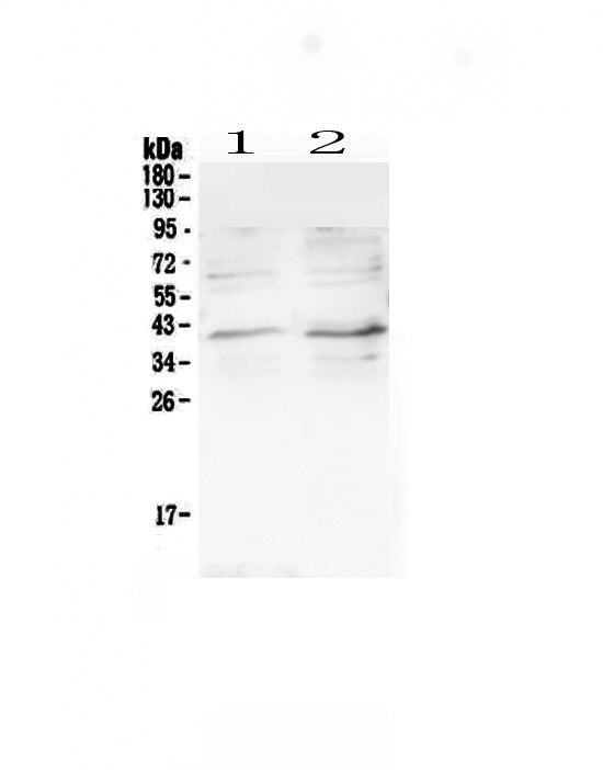 Anti-CCR5 Antibody Picoband® Boster Bio