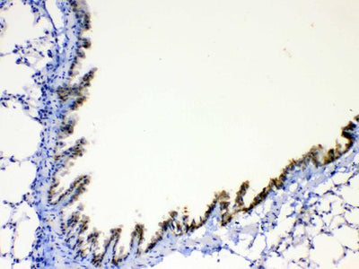 Anti-AGRP Antibody Boster Bio