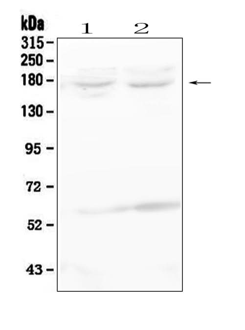 Anti-RET Antibody Picoband® Boster Bio