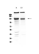 Anti-BMPR2 Antibody Picoband® Boster Bio