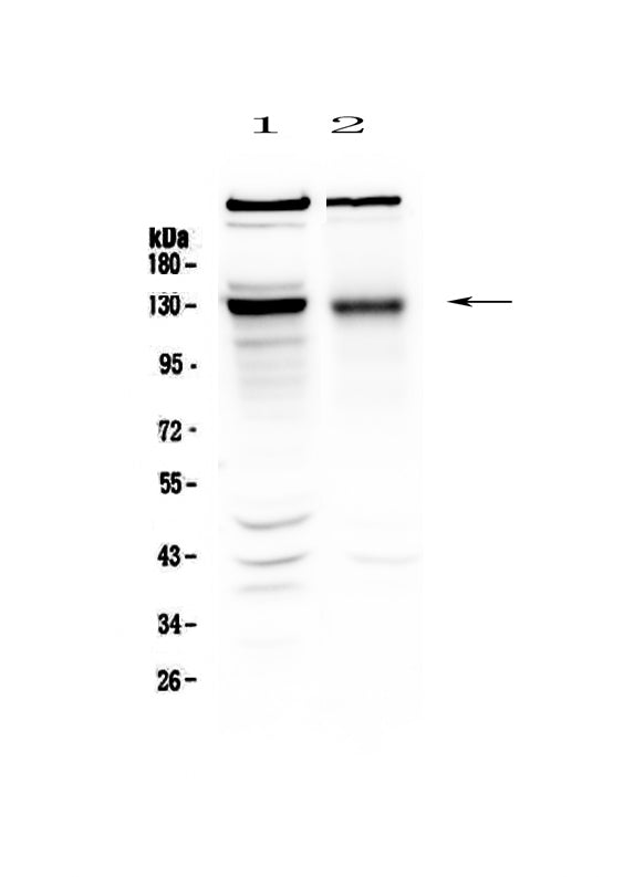 Anti-BMPR2 Antibody Picoband® Boster Bio