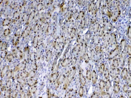 Anti-GST3/GST pi/Gstp1 Antibody Picoband® Boster Bio