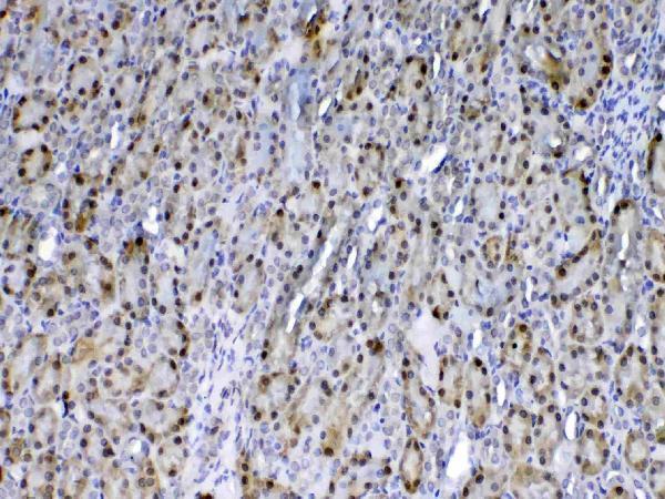 Anti-GST3/GST pi/Gstp1 Antibody Picoband® Boster Bio