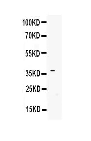 Anti-IGFBP3 Antibody Picoband® Boster Bio