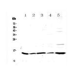 Anti-Galectin 1/Lgals1 Antibody Picoband® Boster Bio