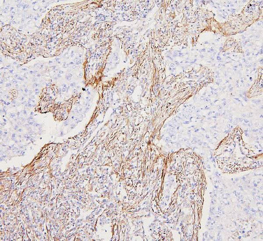 Anti-Filamin A/FLNA Antibody Picoband® Boster Bio