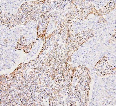Anti-Filamin A/FLNA Antibody Picoband® Boster Bio