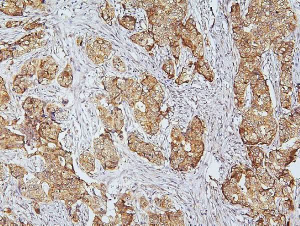 Anti-CDK5 Antibody Picoband® Boster Bio