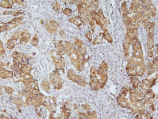 Anti-CDK5 Antibody Picoband® Boster Bio