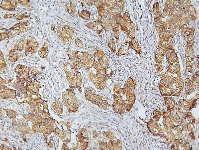Anti-CDK5 Antibody Picoband® Boster Bio