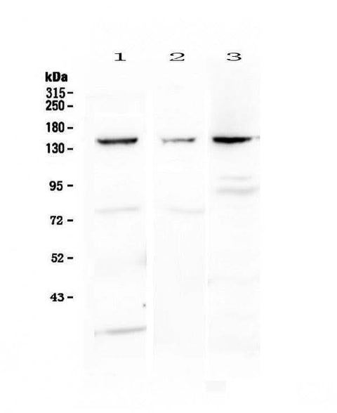 Anti-VEGF Receptor 1/FLT1 Antibody Picoband® Boster Bio