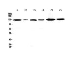 Anti-VEGF Receptor 1/FLT1 Antibody Picoband® Boster Bio