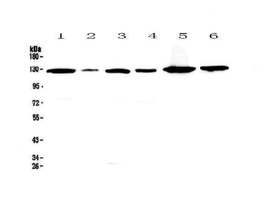 Anti-VEGF Receptor 1/FLT1 Antibody Picoband® Boster Bio
