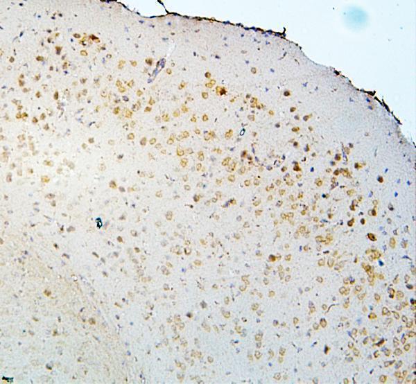 Anti-DCC Antibody Picoband® Boster Bio