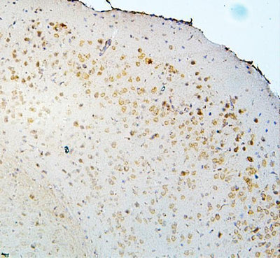 Anti-DCC Antibody Picoband® Boster Bio