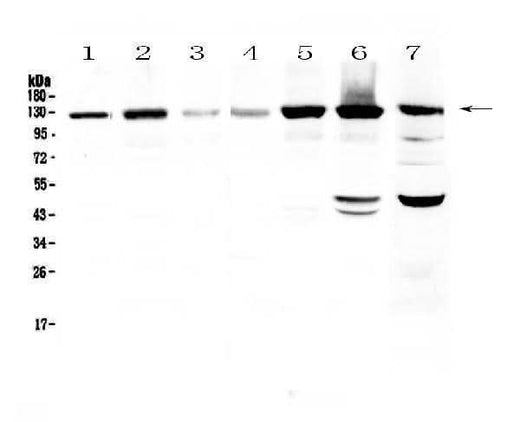 Anti-Eph receptor A2/EPHA2 Antibody Picoband® Boster Bio
