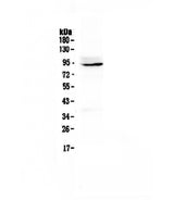 Anti-PTPN22 Antibody Picoband® Boster Bio