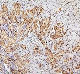Anti-SUZ12 Antibody Picoband® Boster Bio